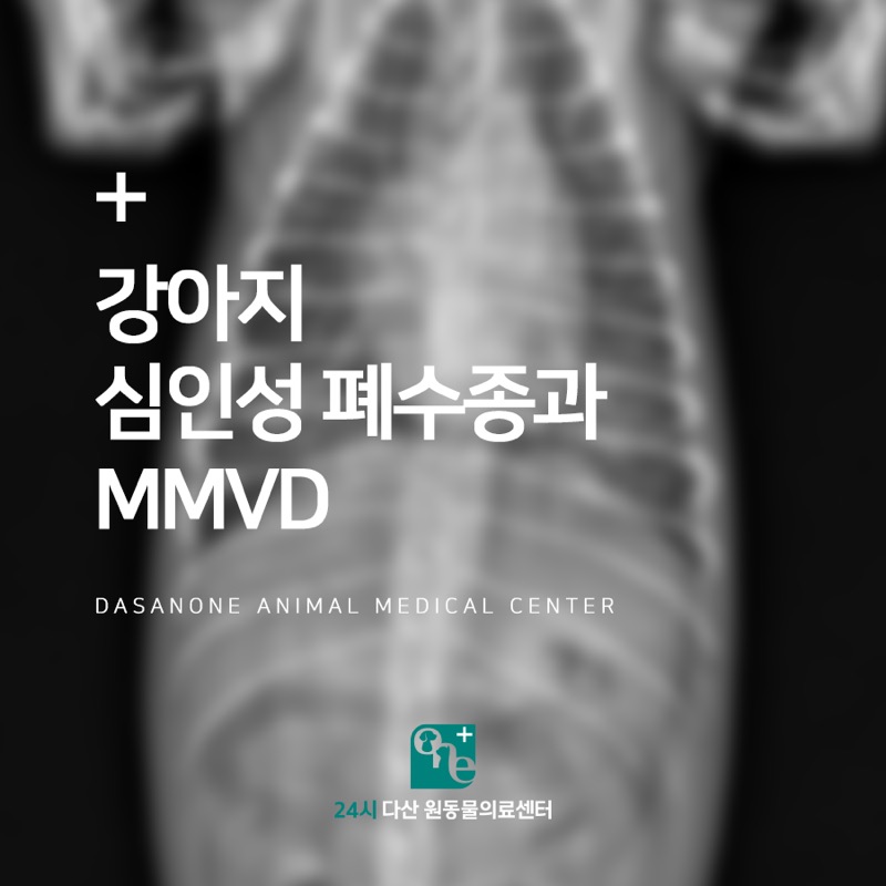 심한 호흡곤란, 심인성 폐수종과 MMVD 치료 후기